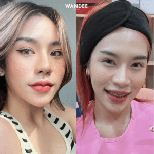 ทรงปากกระจับ